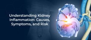 Understanding Kidney Inflammation: Causes, Symptoms, and Risk
