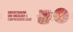 Understanding Uro-Oncology: A Comprehensive Guide