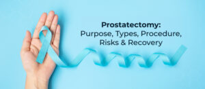 Prostatectomy: Purpose, Types, Procedure, Risks & Recovery
