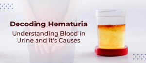 Decoding Hematuria: Understanding Blood in Urine and it’s Causes